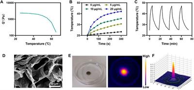 Cu-doped polypyrrole hydrogel with tumor catalyst activity for NIR-II thermo-radiotherapy